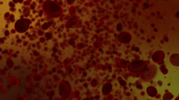 Sepsis (blodförgiftning): symtom, orsaker & behandling